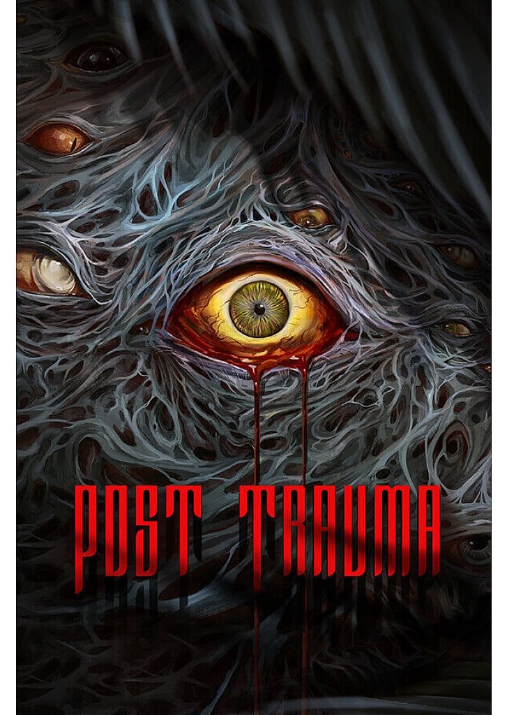 Post Trauma